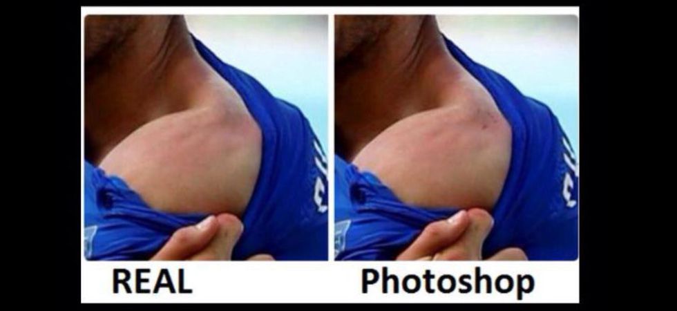 suarez-bite-2